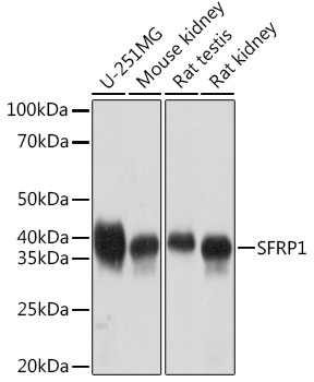 Western blot analysis of various lysates using SFRP1 Rabbit mAb at 1:1000 dilution.|Secondary antibody: HRP-conjugated Goat anti-Rabbit IgG (H+L) at 1:10000 dilution.|Lysates/proteins: 25μg per lane.|Blocking buffer: 3% nonfat dry milk in TBST.|Detection: ECL Basic Kit.|Exposure time: 10s.