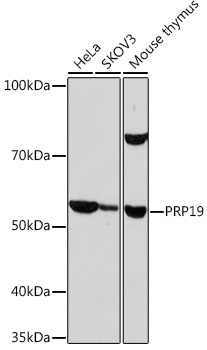 Western blot analysis of various lysates using PRP19 Rabbit mAb at 1:1000 dilution.|Secondary antibody: HRP-conjugated Goat anti-Rabbit IgG (H+L) at 1:10000 dilution.|Lysates/proteins: 25μg per lane.|Blocking buffer: 3% nonfat dry milk in TBST.|Detection: ECL Basic Kit.|Exposure time: 10s.