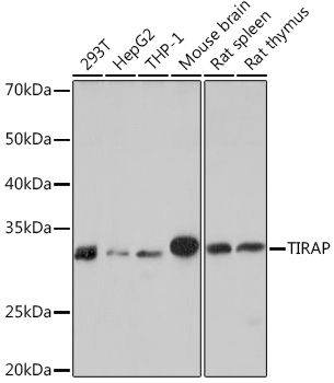 Western blot analysis of various lysates using TIRAP Rabbit mAb (A9663) at 1:1000 dilution.|Secondary antibody: HRP-conjugated Goat anti-Rabbit IgG (H+L) (AS014) at 1:10000 dilution.|Lysates/proteins: 25μg per lane.|Blocking buffer: 3% nonfat dry milk in TBST.|Detection: ECL Basic Kit (RM00020).|Exposure time: 10s.