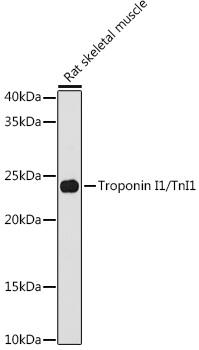Western blot analysis of lysates from Rat skeletal muscle, using Troponin I1/TnI1 Rabbit mAb (A9664) at 1:1000 dilution.|Secondary antibody: HRP-conjugated Goat anti-Rabbit IgG (H+L) (AS014) at 1:10000 dilution.|Lysates/proteins: 25μg per lane.|Blocking buffer: 3% nonfat dry milk in TBST.|Detection: ECL Basic Kit (RM00020).|Exposure time: 180s.