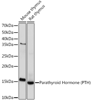 Western blot analysis of various lysates using Parathyroid Hormone (PTH) Rabbit mAb at 1:1000 dilution.|Secondary antibody: HRP-conjugated Goat anti-Rabbit IgG (H+L) at 1:10000 dilution.|Lysates/proteins: 25μg per lane.|Blocking buffer: 3% nonfat dry milk in TBST.|Detection: ECL Basic Kit.|Exposure time: 10s.