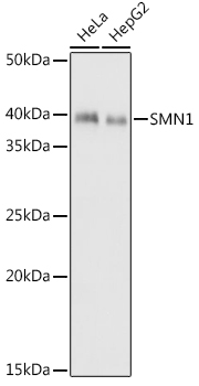 Western blot analysis of various lysates using SMN1 Rabbit mAb at 1:1000 dilution.|Secondary antibody: HRP-conjugated Goat anti-Rabbit IgG (H+L) at 1:10000 dilution.|Lysates/proteins: 25μg per lane.|Blocking buffer: 3% nonfat dry milk in TBST.|Detection: ECL Basic Kit.|Exposure time: 1s.