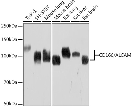 Western blot analysis of various lysates using CD166/ALCAM Rabbit mAb at 1:1000 dilution.|Secondary antibody: HRP-conjugated Goat anti-Rabbit IgG (H+L) at 1:10000 dilution.|Lysates/proteins: 25μg per lane.|Blocking buffer: 3% nonfat dry milk in TBST.|Detection: ECL Basic Kit.|Exposure time: 30s.