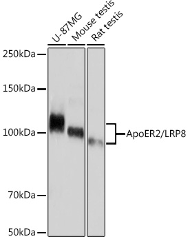 Western blot analysis of various lysates using ApoER2/LRP8 Rabbit mAb at 1:1000 dilution.|Secondary antibody: HRP-conjugated Goat anti-Rabbit IgG (H+L) at 1:10000 dilution.|Lysates/proteins: 25μg per lane.|Blocking buffer: 3% nonfat dry milk in TBST.|Detection: ECL Basic Kit.|Exposure time: 30s.