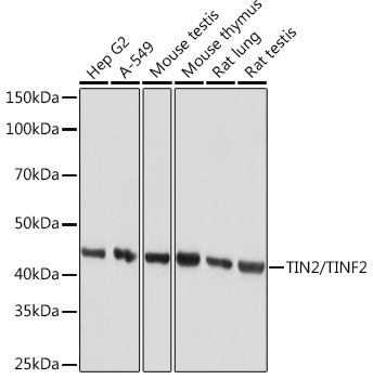 Western blot analysis of various lysates using TIN2/TINF2 Rabbit mAb (A9750) at 1:1000 dilution incubated overnight at 4°C|Secondary antibody: HRP-conjugated Goat anti-Rabbit IgG (H+L) (AS014) at 1:10000 dilution.|Lysates/proteins: 25 μg per lane.|Blocking buffer: 3% nonfat dry milk in TBST.|Detection: ECL Basic Kit (RM00020).|Exposure time: 10 s.
