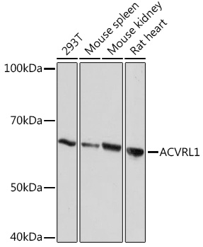 Western blot analysis of various lysates using ACVRL1 Rabbit mAb at 1:1000 dilution.|Secondary antibody: HRP-conjugated Goat anti-Rabbit IgG (H+L) at 1:10000 dilution.|Lysates/proteins: 25μg per lane.|Blocking buffer: 3% nonfat dry milk in TBST.|Detection: ECL Basic Kit.|Exposure time: 10s.