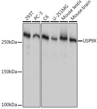 Western blot analysis of various lysates using USP9X Rabbit mAb (A9782) at 1:1000 dilution.|Secondary antibody: HRP-conjugated Goat anti-Rabbit IgG (H+L) (AS014) at 1:10000 dilution.|Lysates/proteins: 25μg per lane.|Blocking buffer: 3% nonfat dry milk in TBST.|Detection: ECL Basic Kit (RM00020).|Exposure time: 1s.