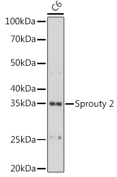 Western blot analysis of lysates from C6 cells, using Sprouty 2 Rabbit mAb at 1:1000 dilution.|Secondary antibody: HRP-conjugated Goat anti-Rabbit IgG (H+L) at 1:10000 dilution.|Lysates/proteins: 25μg per lane.|Blocking buffer: 3% nonfat dry milk in TBST.|Detection: ECL Basic Kit.|Exposure time: 10s.