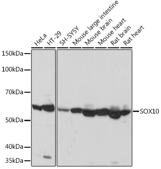Western blot analysis of various lysates using SOX10 Rabbit mAb at 1:1000 dilution.|Secondary antibody: HRP-conjugated Goat anti-Rabbit IgG (H+L) at 1:10000 dilution.|Lysates/proteins: 25μg per lane.|Blocking buffer: 3% nonfat dry milk in TBST.|Detection: ECL Basic Kit.|Exposure time: 5s.