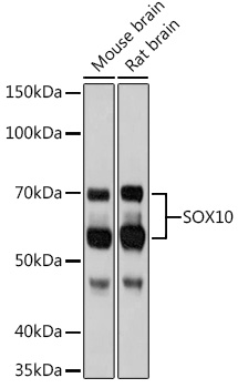 Western blot analysis of various lysates using SOX10 Rabbit mAb at 1:1000 dilution.|Secondary antibody: HRP-conjugated Goat anti-Rabbit IgG (H+L) at 1:10000 dilution.|Lysates/proteins: 25μg per lane.|Blocking buffer: 3% nonfat dry milk in TBST.|Detection: ECL Basic Kit.|Exposure time: 3min.
