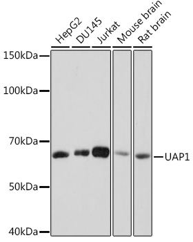 Western blot analysis of various lysates using UAP1 Rabbit mAb (A8662) at 1:1000 dilution.|Secondary antibody: HRP-conjugated Goat anti-Rabbit IgG (H+L) (AS014) at 1:10000 dilution.|Lysates/proteins: 25μg per lane.|Blocking buffer: 3% nonfat dry milk in TBST.|Detection: ECL Basic Kit (RM00020).|Exposure time: 10s.
