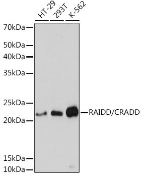 Western blot analysis of various lysates using RAIDD/CRADD Rabbit mAb at 1:3000 dilution.|Secondary antibody: HRP-conjugated Goat anti-Rabbit IgG (H+L) at 1:10000 dilution.|Lysates/proteins: 25μg per lane.|Blocking buffer: 3% nonfat dry milk in TBST.|Detection: ECL Basic Kit.|Exposure time: 30s.