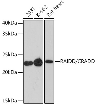 Western blot analysis of various lysates using RAIDD/CRADD Rabbit mAb at 1:1000 dilution.|Secondary antibody: HRP-conjugated Goat anti-Rabbit IgG (H+L) at 1:10000 dilution.|Lysates/proteins: 25μg per lane.|Blocking buffer: 3% nonfat dry milk in TBST.|Detection: ECL Enhanced Kit.|Exposure time: 3min.