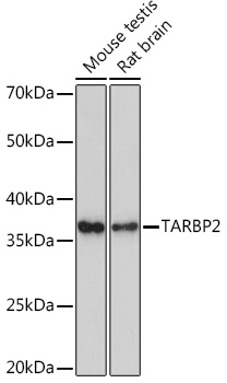 Western blot analysis of various lysates using TARBP2 Rabbit mAb at 1:1000 dilution.|Secondary antibody: HRP-conjugated Goat anti-Rabbit IgG (H+L) at 1:10000 dilution.|Lysates/proteins: 25μg per lane.|Blocking buffer: 3% nonfat dry milk in TBST.|Detection: ECL Enhanced Kit.|Exposure time: 3min.