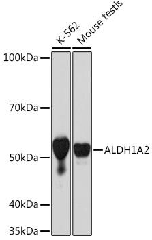 Western blot analysis of various lysates using ALDH1A2 Rabbit mAb at 1:1000 dilution.|Secondary antibody: HRP-conjugated Goat anti-Rabbit IgG (H+L) at 1:10000 dilution.|Lysates/proteins: 25μg per lane.|Blocking buffer: 3% nonfat dry milk in TBST.|Detection: ECL Basic Kit.|Exposure time: 30s.