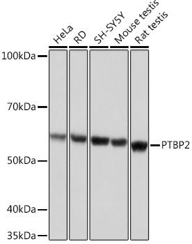 Western blot analysis of various lysates using PTBP2 Rabbit mAb at 1:1000 dilution.|Secondary antibody: HRP-conjugated Goat anti-Rabbit IgG (H+L) at 1:10000 dilution.|Lysates/proteins: 25μg per lane.|Blocking buffer: 3% nonfat dry milk in TBST.|Detection: ECL Basic Kit.|Exposure time: 1s.