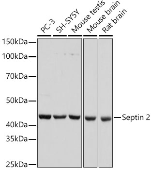 Western blot analysis of various lysates, using Septin 2 Rabbit mAb at 1:1000 dilution.|Secondary antibody: HRP-conjugated Goat anti-Rabbit IgG (H+L) at 1:10000 dilution.|Lysates/proteins: 25μg  per lane.|Blocking buffer: 3% nonfat dry milk in TBST.|Detection: ECL Basic Kit.|Exposure time: 10s.