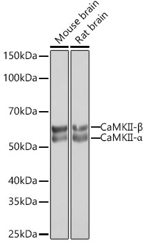 Western blot analysis of various lysates using CaMKII Rabbit mAb at 1:1000 dilution.|Secondary antibody: HRP-conjugated Goat anti-Rabbit IgG (H+L) at 1:10000 dilution.|Lysates/proteins: 25μg per lane.|Blocking buffer: 3% nonfat dry milk in TBST.|Detection: ECL Basic Kit.|Exposure time: 5s.