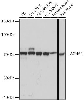 Western blot analysis of various lysates using ACHA4 Rabbit mAb at 1:1000 dilution.|Secondary antibody: HRP-conjugated Goat anti-Rabbit IgG (H+L) at 1:10000 dilution.|Lysates/proteins: 25μg per lane.|Blocking buffer: 3% nonfat dry milk in TBST.|Detection: ECL Basic Kit.|Exposure time: 1s.