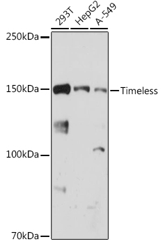 Western blot analysis of various lysates using Timeless Rabbit mAb (A0512) at 1:1000 dilution.|Secondary antibody: HRP-conjugated Goat anti-Rabbit IgG (H+L) (AS014) at 1:10000 dilution.|Lysates/proteins: 25μg per lane.|Blocking buffer: 3% nonfat dry milk in TBST.|Detection: ECL Basic Kit (RM00020).|Exposure time: 30s.