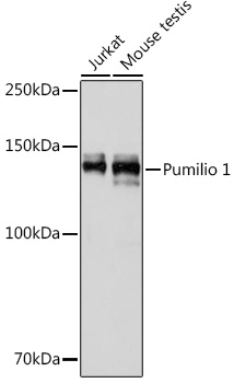 Western blot analysis of various lysates using Pumilio 1 Rabbit mAb at 1:1000 dilution.|Secondary antibody: HRP-conjugated Goat anti-Rabbit IgG (H+L) at 1:10000 dilution.|Lysates/proteins: 25μg per lane.|Blocking buffer: 3% nonfat dry milk in TBST.|Detection: ECL Basic Kit.|Exposure time: 10s.