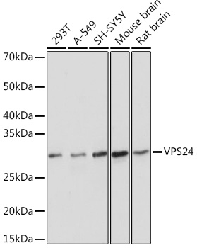 Western blot analysis of various lysates using VPS24 Rabbit mAb (A0941) at 1:1000 dilution.|Secondary antibody: HRP-conjugated Goat anti-Rabbit IgG (H+L) (AS014) at 1:10000 dilution.|Lysates/proteins: 25μg per lane.|Blocking buffer: 3% nonfat dry milk in TBST.|Detection: ECL Basic Kit (RM00020).|Exposure time: 5s.