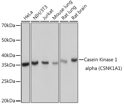 Western blot analysis of various lysates using Casein Kinase 1 alpha (CSNK1A1) Rabbit mAb at 1:1000 dilution.|Secondary antibody: HRP-conjugated Goat anti-Rabbit IgG (H+L) at 1:10000 dilution.|Lysates/proteins: 25μg per lane.|Blocking buffer: 3% nonfat dry milk in TBST.|Detection: ECL Basic Kit.|Exposure time: 1s.