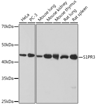 Western blot analysis of various lysates using S1PR3 Rabbit mAb at 1:1000 dilution.|Secondary antibody: HRP-conjugated Goat anti-Rabbit IgG (H+L) at 1:10000 dilution.|Lysates/proteins: 25μg per lane.|Blocking buffer: 3% nonfat dry milk in TBST.|Detection: ECL Basic Kit.|Exposure time: 10s.
