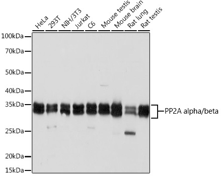 Western blot analysis of various lysates using PP2A alpha/beta Rabbit mAb at 1:1000 dilution.|Secondary antibody: HRP-conjugated Goat anti-Rabbit IgG (H+L) at 1:10000 dilution.|Lysates/proteins: 25μg per lane.|Blocking buffer: 3% nonfat dry milk in TBST.|Detection: ECL Basic Kit.|Exposure time: 3 s.