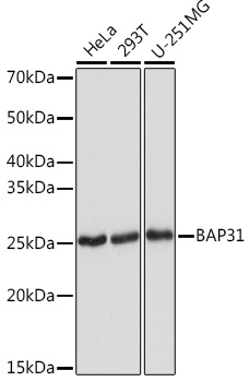 Western blot analysis of various lysates using BAP31 Rabbit mAb at 1:1000 dilution.|Secondary antibody: HRP-conjugated Goat anti-Rabbit IgG (H+L) at 1:10000 dilution.|Lysates/proteins: 25μg per lane.|Blocking buffer: 3% nonfat dry milk in TBST.|Detection: ECL Basic Kit.|Exposure time: 1s.