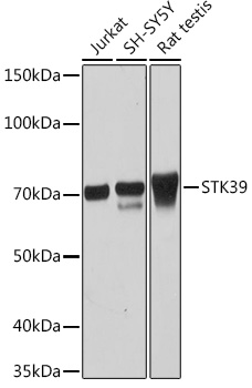 Western blot analysis of various lysates using STK39 Rabbit mAb at 1:1000 dilution.|Secondary antibody: HRP-conjugated Goat anti-Rabbit IgG (H+L) at 1:10000 dilution.|Lysates/proteins: 25μg per lane.|Blocking buffer: 3% nonfat dry milk in TBST.|Detection: ECL Basic Kit.|Exposure time: 10s.