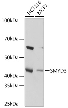 Western blot analysis of various lysates using SMYD3 Rabbit mAb at 1:1000 dilution.|Secondary antibody: HRP-conjugated Goat anti-Rabbit IgG (H+L) at 1:10000 dilution.|Lysates/proteins: 25μg per lane.|Blocking buffer: 3% nonfat dry milk in TBST.|Detection: ECL Basic Kit.|Exposure time: 1s.