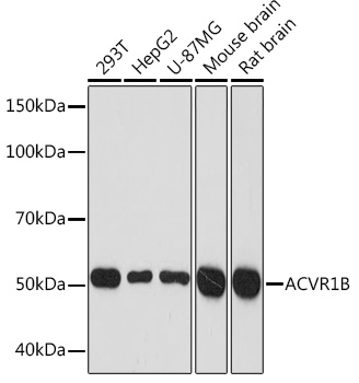 Western blot analysis of various lysates using ACVR1B Rabbit mAb at 1:1000 dilution.|Secondary antibody: HRP-conjugated Goat anti-Rabbit IgG (H+L) at 1:10000 dilution.|Lysates/proteins: 25μg per lane.|Blocking buffer: 3% nonfat dry milk in TBST.|Detection: ECL Basic Kit.|Exposure time: 3min.
