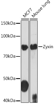Western blot analysis of various lysates using Zyxin Rabbit mAb (A2298) at 1:1000 dilution.|Secondary antibody: HRP-conjugated Goat anti-Rabbit IgG (H+L) (AS014) at 1:10000 dilution.|Lysates/proteins: 25μg per lane.|Blocking buffer: 3% nonfat dry milk in TBST.|Detection: ECL Basic Kit (RM00020).|Exposure time: 90s.