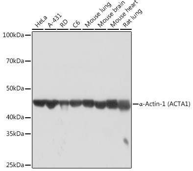 Western blot analysis of various lysates using α-Actin-1 Rabbit mAb at 1:1000 dilution.|Secondary antibody: HRP-conjugated Goat anti-Rabbit IgG (H+L) at 1:10000 dilution.|Lysates/proteins: 25μg per lane.|Blocking buffer: 3% nonfat dry milk in TBST.|Detection: ECL Basic Kit.|Exposure time: 10s.