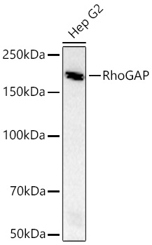Western blot analysis of lysates from Hep G2 cells using RhoGAP Rabbit mAb at 1:1000 dilution incubated overnight at 4℃.|Secondary antibody: HRP-conjugated Goat anti-Rabbit IgG (H+L) at 1:10000 dilution.|Lysates/proteins: 25 μg per lane.|Blocking buffer: 3% nonfat dry milk in TBST.|Detection: ECL Basic Kit.|Exposure time: 90 s.