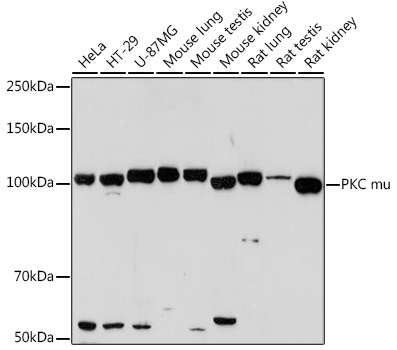 Western blot analysis of various lysates using PKC mu Rabbit mAb at 1:1000 dilution.|Secondary antibody: HRP-conjugated Goat anti-Rabbit IgG (H+L) at 1:10000 dilution.|Lysates/proteins: 25 μg per lane.|Blocking buffer: 3% nonfat dry milk in TBST.|Detection: ECL Enhanced Kit.|Exposure time: 180 s.