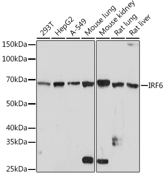 Western blot analysis of various lysates using IRF6 Rabbit mAb at 1:1000 dilution.|Secondary antibody: HRP-conjugated Goat anti-Rabbit IgG (H+L) at 1:10000 dilution.|Lysates/proteins: 25μg per lane.|Blocking buffer: 3% nonfat dry milk in TBST.|Detection: ECL Basic Kit.|Exposure time: 3min.