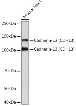 Western blot analysis of lysates from Mouse heart, using Cadherin-13 (CDH13) Rabbit mAb at 1:1000 dilution.|Secondary antibody: HRP-conjugated Goat anti-Rabbit IgG (H+L) at 1:10000 dilution.|Lysates/proteins: 25μg per lane.|Blocking buffer: 3% nonfat dry milk in TBST.|Detection: ECL Basic Kit.|Exposure time: 3min.