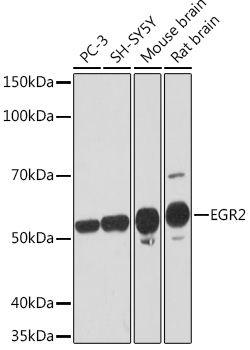Western blot analysis of various lysates using EGR2 Rabbit mAb at 1:1000 dilution.|Secondary antibody: HRP-conjugated Goat anti-Rabbit IgG (H+L) at 1:10000 dilution.|Lysates/proteins: 25μg per lane.|Blocking buffer: 3% nonfat dry milk in TBST.|Detection: ECL Basic Kit.|Exposure time: 3min.
