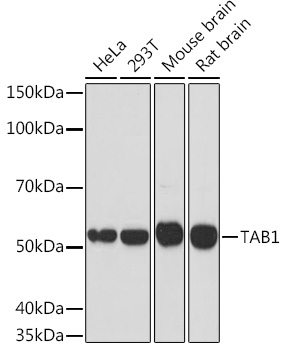 Western blot analysis of various lysates using TAB1 Rabbit mAb at 1:1000 dilution.|Secondary antibody: HRP-conjugated Goat anti-Rabbit IgG (H+L) at 1:10000 dilution.|Lysates/proteins: 25μg per lane.|Blocking buffer: 3% nonfat dry milk in TBST.|Detection: ECL Basic Kit.|Exposure time: 90s.