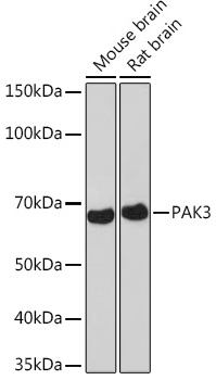 Western blot analysis of various lysates using PAK3 Rabbit mAb at 1:1000 dilution.|Secondary antibody: HRP-conjugated Goat anti-Rabbit IgG (H+L) at 1:10000 dilution.|Lysates/proteins: 25μg per lane.|Blocking buffer: 3% nonfat dry milk in TBST.|Detection: ECL Basic Kit.|Exposure time: 3min.