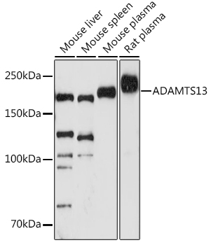 Western blot analysis of various lysates using ADAMTS13 Rabbit mAb at 1:1000 dilution.|Secondary antibody: HRP-conjugated Goat anti-Rabbit IgG (H+L) at 1:10000 dilution.|Lysates/proteins: 25μg per lane.|Blocking buffer: 3% nonfat dry milk in TBST.|Detection: ECL Enhanced Kit.|Exposure time: 180s.