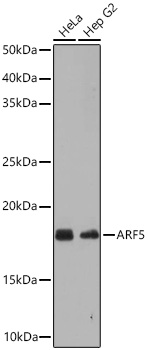 Western blot analysis of various lysates using ARF5 Rabbit mAb at 1:1000 dilution incubated overnight at 4℃.|Secondary antibody: HRP-conjugated Goat anti-Rabbit IgG (H+L) at 1:10000 dilution.|Lysates/proteins: 25 μg per lane.|Blocking buffer: 3% nonfat dry milk in TBST.|Detection: ECL Basic Kit.|Exposure time: 60 s.