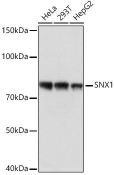 Western blot analysis of various lysates using SNX1 Rabbit mAb at 1:1000 dilution.|Secondary antibody: HRP-conjugated Goat anti-Rabbit IgG (H+L) at 1:10000 dilution.|Lysates/proteins: 25μg per lane.|Blocking buffer: 3% nonfat dry milk in TBST.|Detection: ECL Basic Kit.|Exposure time: 1s.
