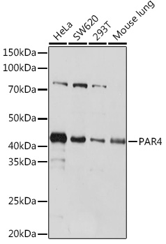 Western blot analysis of various lysates using PAR4 Rabbit mAb at 1:1000 dilution.|Secondary antibody: HRP-conjugated Goat anti-Rabbit IgG (H+L) at 1:10000 dilution.|Lysates/proteins: 25μg per lane.|Blocking buffer: 3% nonfat dry milk in TBST.|Detection: ECL Basic Kit.|Exposure time: 10s.