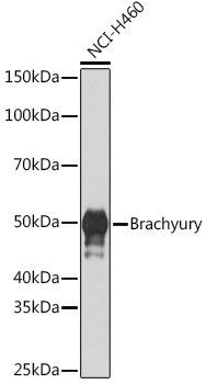 Western blot analysis of lysates from NCI-H460 cells, using Brachyury Rabbit mAb at 1:1000 dilution.|Secondary antibody: HRP-conjugated Goat anti-Rabbit IgG (H+L) at 1:10000 dilution.|Lysates/proteins: 25μg per lane.|Blocking buffer: 3% nonfat dry milk in TBST.|Detection: ECL Basic Kit.|Exposure time: 1s.