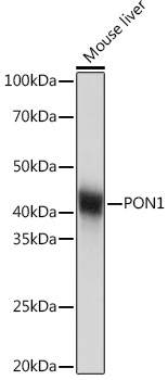 Western blot analysis of lysates from Mouse liver, using PON1 Rabbit mAb at 1:1000 dilution.|Secondary antibody: HRP-conjugated Goat anti-Rabbit IgG (H+L) at 1:10000 dilution.|Lysates/proteins: 25μg per lane.|Blocking buffer: 3% nonfat dry milk in TBST.|Detection: ECL Basic Kit.|Exposure time: 1s.