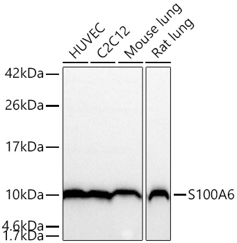 Western blot analysis of various lysates using S100A6 Rabbit mAb at 1:5000 dilution incubated overnight at 4℃.|Secondary antibody: HRP-conjugated Goat anti-Rabbit IgG (H+L) at 1:10000 dilution.|Lysates/proteins: 25 μg per lane.|Blocking buffer: 3% nonfat dry milk in TBST.|Detection: ECL Basic Kit.|Exposure time: 5 s.