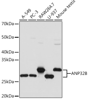 Western blot analysis of various lysates using ANP32B Rabbit mAb at 1:1000 dilution.|Secondary antibody: HRP-conjugated Goat anti-Rabbit IgG (H+L) at 1:10000 dilution.|Lysates/proteins: 25μg per lane.|Blocking buffer: 3% nonfat dry milk in TBST.|Detection: ECL Basic Kit.|Exposure time: 3s.
